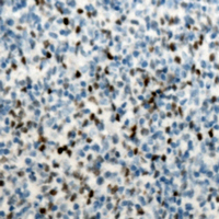SPI1 / PU.1 Antibody - Immunohistochemical analysis of PU.1 staining in human lymph node formalin fixed paraffin embedded tissue section. The section was pre-treated using heat mediated antigen retrieval with sodium citrate buffer (pH 6.0). The section was then incubated with the antibody at room temperature and detected using an HRP conjugated compact polymer system. DAB was used as the chromogen. The section was then counterstained with hematoxylin and mounted with DPX.