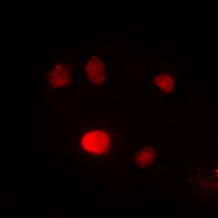 SPI1 / PU.1 Antibody - Immunofluorescent analysis of PU.1 staining in HepG2 cells. Formalin-fixed cells were permeabilized with 0.1% Triton X-100 in TBS for 5-10 minutes and blocked with 3% BSA-PBS for 30 minutes at room temperature. Cells were probed with the primary antibody in 3% BSA-PBS and incubated overnight at 4 deg C in a humidified chamber. Cells were washed with PBST and incubated with a DyLight 594-conjugated secondary antibody (red) in PBS at room temperature in the dark. DAPI was used to stain the cell nuclei (blue).
