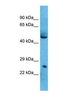 SPI1 / PU.1 Antibody - Western blot of Human Lung Tumor. SPI1 antibody dilution 1.0 ug/ml.  This image was taken for the unconjugated form of this product. Other forms have not been tested.
