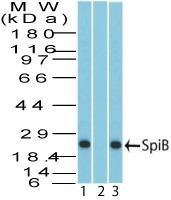 SPIB Antibody - Western Blot: SPIB Antibody - Analysis of Spi-B in human Daudi lysate in the 1) absence and 2) presence of immunizing peptide and 3) on mouse RAW lysate using Spi-B polyclonal antibody at 4 ug/ml.