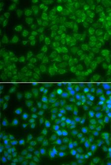 SPIB Antibody - Immunofluorescence analysis of A549 cells.