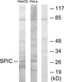 SPIC Antibody - Western blot analysis of lysates from HepG2 and HeLa cells, using SPIC Antibody. The lane on the right is blocked with the synthesized peptide.