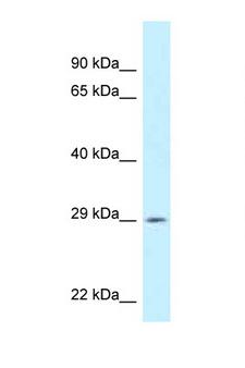 SPIC Antibody - SPIC antibody Western blot of ACHN Cell lysate. Antibody concentration 1 ug/ml.  This image was taken for the unconjugated form of this product. Other forms have not been tested.