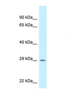 SPIC Antibody - SPIC antibody Western blot of ACHN Cell lysate. Antibody concentration 1 ug/ml.  This image was taken for the unconjugated form of this product. Other forms have not been tested.