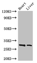 SPIC Antibody - Western Blot Positive WB detected in: Mouse heart tissue, Mouse liver tissue All lanes: SPIC antibody at 3.4µg/ml Secondary Goat polyclonal to rabbit IgG at 1/50000 dilution Predicted band size: 30 kDa Observed band size: 30 kDa