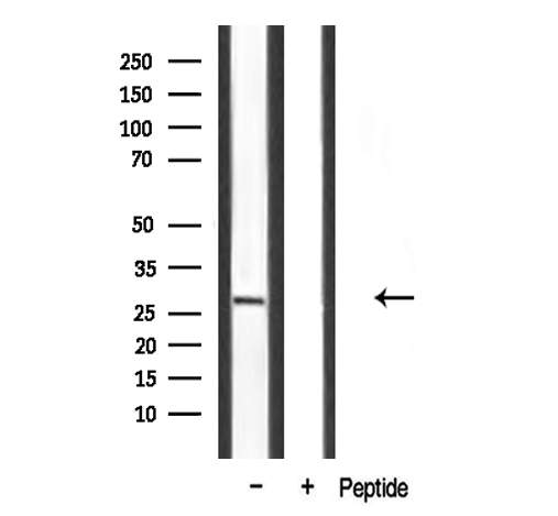 SPIC Antibody - Western blot analysis of extracts of mouse brain using SPIC antibody.