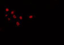 SPIC Antibody - Staining HepG2 cells by IF/ICC. The samples were fixed with PFA and permeabilized in 0.1% Triton X-100, then blocked in 10% serum for 45 min at 25°C. The primary antibody was diluted at 1:200 and incubated with the sample for 1 hour at 37°C. An Alexa Fluor 594 conjugated goat anti-rabbit IgG (H+L) antibody, diluted at 1/600, was used as secondary antibody.