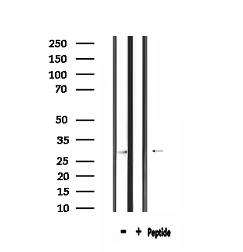 SPIC Antibody - Western blot analysis of extracts of HepG2 cells using SPIC antibody.