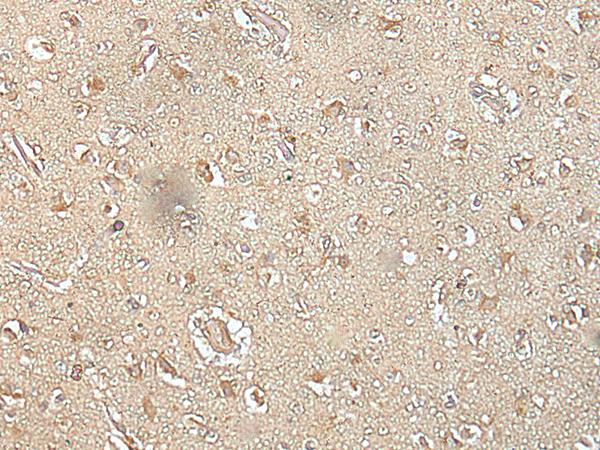SPIC Antibody - Immunohistochemistry of paraffin-embedded Human brain tissue  using SPIC Polyclonal Antibody at dilution of 1:35(×200)