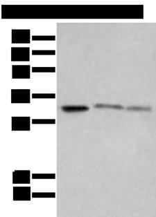 SPIC Antibody - Western blot analysis of SP20 Raji and Jurkat cell lysates  using SPIC Polyclonal Antibody at dilution of 1:650