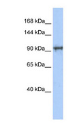 SPICE1 / CCDC52 Antibody - SPICE1 / CCDC52 antibody Western blot of Transfected 293T cell lysate. This image was taken for the unconjugated form of this product. Other forms have not been tested.
