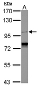 SPICE1 / CCDC52 Antibody - Sample (30 ug of whole cell lysate) A: A431 7.5% SDS PAGE SPICE1 / CCDC52 antibody diluted at 1:1000