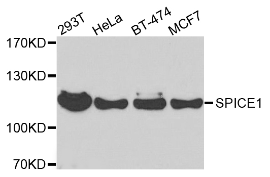 SPICE1 / CCDC52 Antibody - Western blot analysis of extracts of various cells.