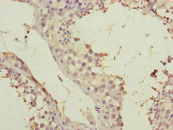 SPICE1 / CCDC52 Antibody - Immunohistochemistry of paraffin-embedded human testis tissue at dilution of 1:100