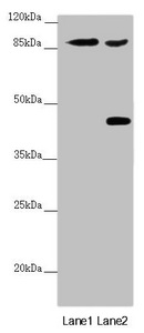 SPICE1 / CCDC52 Antibody - Western blot All Lanes:SPICE1 antibody at 5.43 ug/ml Lane 1: Mouse gonadal tissue Lane 2: 293T whole cell lysate Secondary Goat polyclonal to rabbit IgG at 1/10000 dilution Predicted band size: 96 kDa Observed band size: 96,45 kDa