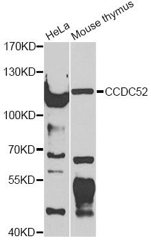 SPICE1 / CCDC52 Antibody - Western blot analysis of extracts of various cell lines, using SPICE1 antibody at 1:1000 dilution. The secondary antibody used was an HRP Goat Anti-Rabbit IgG (H+L) at 1:10000 dilution. Lysates were loaded 25ug per lane and 3% nonfat dry milk in TBST was used for blocking. An ECL Kit was used for detection and the exposure time was 90s.