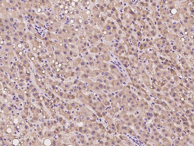 SPICE1 / CCDC52 Antibody - Immunochemical staining of human SPICE1 in human liver with rabbit polyclonal antibody at 1:100 dilution, formalin-fixed paraffin embedded sections.