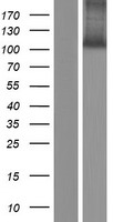 SPIDR / KIAA0146 Protein - Western validation with an anti-DDK antibody * L: Control HEK293 lysate R: Over-expression lysate