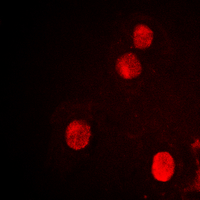 SPIN / SPIN1 Antibody - Immunofluorescent analysis of SPIN1 staining in HEK293T cells. Formalin-fixed cells were permeabilized with 0.1% Triton X-100 in TBS for 5-10 minutes and blocked with 3% BSA-PBS for 30 minutes at room temperature. Cells were probed with the primary antibody in 3% BSA-PBS and incubated overnight at 4 deg C in a humidified chamber. Cells were washed with PBST and incubated with a DyLight 594-conjugated secondary antibody (red) in PBS at room temperature in the dark. DAPI was used to stain the cell nuclei (blue).