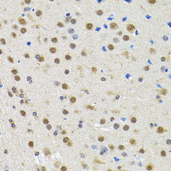 SPIN / SPIN1 Antibody - Immunohistochemistry of paraffin-embedded rat brain tissue.