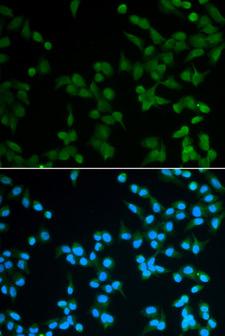 SPIN / SPIN1 Antibody - Immunofluorescence analysis of A549 cells.