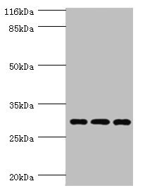 SPIN / SPIN1 Antibody - Western blot All Lanes:SPIN1 antibody at 1.45ug/ml Lane 1:Hela whole cell lysate Lane 2:293T whole cell lysate Lane 3:HepG2 whole cell lysate Secondary Goat polyclonal to rabbit at 1/10000 dilution Predicted band size: 30kDa Observed band size: 30kDa