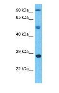 SPIN / SPIN1 Antibody - Western blot of SPIN1 Antibody with human Ovary Tumor lysate.  This image was taken for the unconjugated form of this product. Other forms have not been tested.