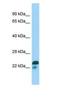 SPIN2A Antibody - SPIN2A antibody Western Blot of Jurkat.  This image was taken for the unconjugated form of this product. Other forms have not been tested.