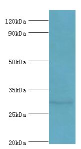 SPIN2B Antibody - Western blot. All lanes: Spindlin-2B antibody at 4 ug/ml+mouse gastric tissue. Secondary antibody: Goat polyclonal to rabbit at 1:10000 dilution. Predicted band size: 29 kDa. Observed band size: 29 kDa Immunohistochemistry.