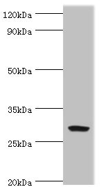 SPIN2B Antibody - Western blot All lanes: Spindlin-2B antibody at 4µg/ml + Mouse gastric tissue Secondary Goat polyclonal to rabbit IgG at 1/10000 dilution Predicted band size: 29 kDa Observed band size: 29 kDa