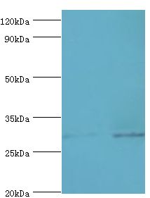 SPIN2B Antibody - Western blot. All lanes: Spindlin-2B antibody at 4 ug/ml. Lane 1: mouse liver tissue. Lane 2: mouse heart tissue. Secondary antibody: Goat polyclonal to rabbit at 1:10000 dilution. Predicted band size: 29 kDa. Observed band size: 29 kDa Immunohistochemistry.