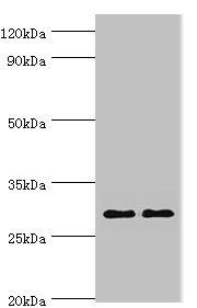 SPIN2B Antibody - Western blot All lanes: Spindlin-2B antibody at 4µg/ml Lane 1: Mouse liver tissue Lane 2: Mouse heart tissue Secondary Goat polyclonal to rabbit IgG at 1/10000 dilution Predicted band size: 29 kDa Observed band size: 29 kDa