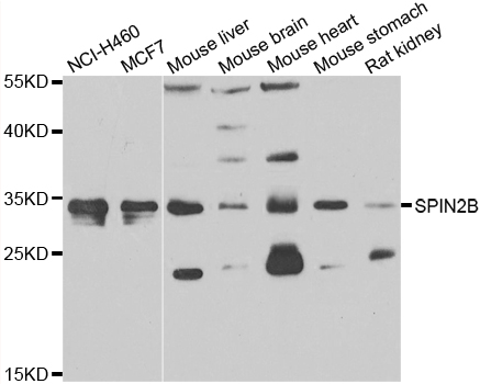 SPIN2B Antibody - Western blot analysis of extracts of various cell lines.