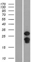 SPIN2B Protein - Western validation with an anti-DDK antibody * L: Control HEK293 lysate R: Over-expression lysate