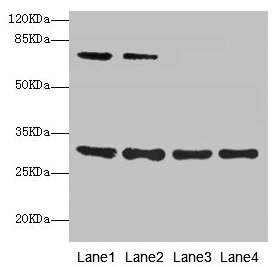 SPIN3 Antibody - Western blot All lanes: SPIN3 antibody at 6µg/ml Lane 1: A549 whole cell lysate Lane 2: Hela whole cell lysate Lane 3: A431 whole cell lysate Lane 4: HepG2 whole cell lysate Secondary Goat polyclonal to rabbit IgG at 1/10000 dilution Predicted band size: 30, 9 kDa Observed band size: 30, 70 kDa