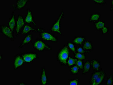 SPIN4 Antibody - Immunofluorescent analysis of A549 cells using SPIN4 Antibody at dilution of 1:100 and Alexa Fluor 488-congugated AffiniPure Goat Anti-Rabbit IgG(H+L)