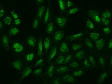 SPIN4 Antibody - Immunofluorescence staining of SPIN4 in U2OS cells. Cells were fixed with 4% PFA, permeabilzed with 0.1% Triton X-100 in PBS, blocked with 10% serum, and incubated with rabbit anti-Human SPIN4 polyclonal antibody (dilution ratio 1:100) at 4°C overnight. Then cells were stained with the Alexa Fluor 488-conjugated Goat Anti-rabbit IgG secondary antibody (green). Positive staining was localized to Nucleus and cytoplasm.