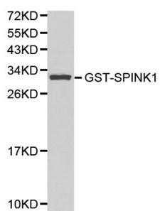 SPINK1 Antibody - Western blot of SPINK1 pAb in extracts from GST-SPINK1 recombinant protein.