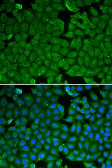 SPINK1 Antibody - Immunofluorescence analysis of HeLa cells.