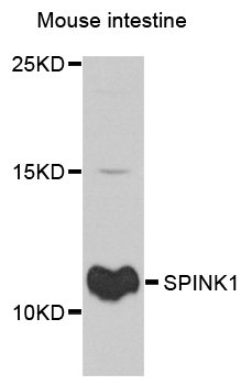 SPINK1 Antibody - Western blot analysis of extracts of mouse intestine, using SPINK1 antibody at 1:1000 dilution. The secondary antibody used was an HRP Goat Anti-Rabbit IgG (H+L) at 1:10000 dilution. Lysates were loaded 25ug per lane and 3% nonfat dry milk in TBST was used for blocking. An ECL Kit was used for detection and the exposure time was 90s.