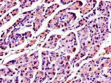SPINK1 Antibody - Immunohistochemistry of paraffin-embedded human pancreatic tissue using SPINK1 Antibody at dilution of 1:100