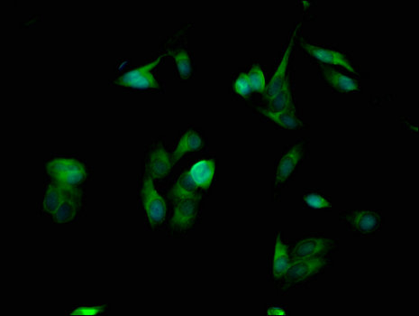 SPINK1 Antibody - Immunofluorescent analysis of Hela cells using SPINK1 Antibody at a dilution of 1:100 and Alexa Fluor 488-congugated AffiniPure Goat Anti-Rabbit IgG(H+L)