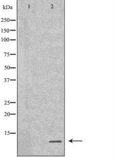 SPINK1 Antibody - Western blot analysis of GST-SPINK1 recombinant protein using SPINK1 antibody. The lane on the left is treated with the antigen-specific peptide.