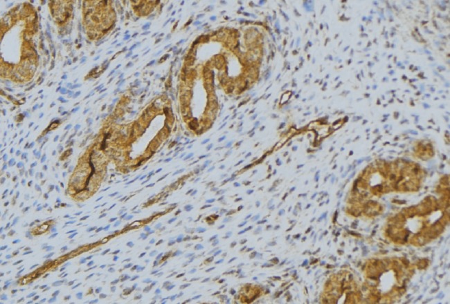 SPINK1 Antibody - 1:100 staining human uterus tissue by IHC-P. The sample was formaldehyde fixed and a heat mediated antigen retrieval step in citrate buffer was performed. The sample was then blocked and incubated with the antibody for 1.5 hours at 22°C. An HRP conjugated goat anti-rabbit antibody was used as the secondary.