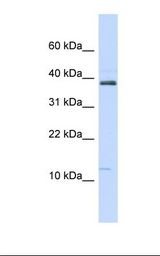 SPINK1 Antibody - MCF7 cell lysate. Antibody concentration: 1.0 ug/ml. Gel concentration: 10-20%.  This image was taken for the unconjugated form of this product. Other forms have not been tested.