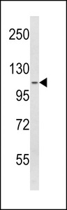 SPINK5 / LEKTI Antibody - Western blot of SPINK5 Antibody in A2058 cell line lysates (35 ug/lane). SPINK5 (arrow) was detected using the purified antibody.