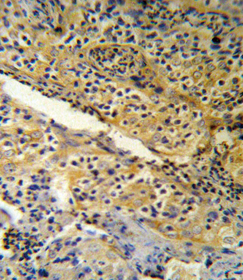 SPINK5 / LEKTI Antibody - SPINK5 Antibody (RB18954) IHC of formalin-fixed and paraffin-embedded human tonsil tissue followed by peroxidase-conjugated secondary antibody and DAB staining.