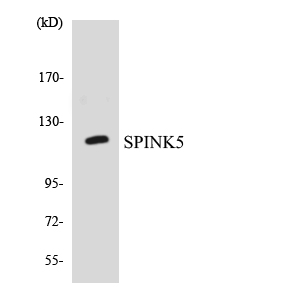 SPINK5 / LEKTI Antibody - Western blot analysis of the lysates from COLO205 cells using SPINK5 antibody.