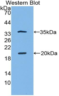 SPINK5 / LEKTI Antibody - Western blot of recombinant SPINK5 / LEKTI.  This image was taken for the unconjugated form of this product. Other forms have not been tested.