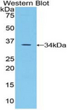 SPINK5 / LEKTI Antibody - Western blot of recombinant SPINK5 / LEKTI.